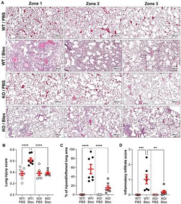 Function of KvLQT1 potassium channels in a mouse model of bleomycin-induced acute lung injury